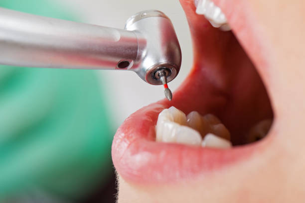 Best Pediatric Emergency Dentist in Mabank, TX